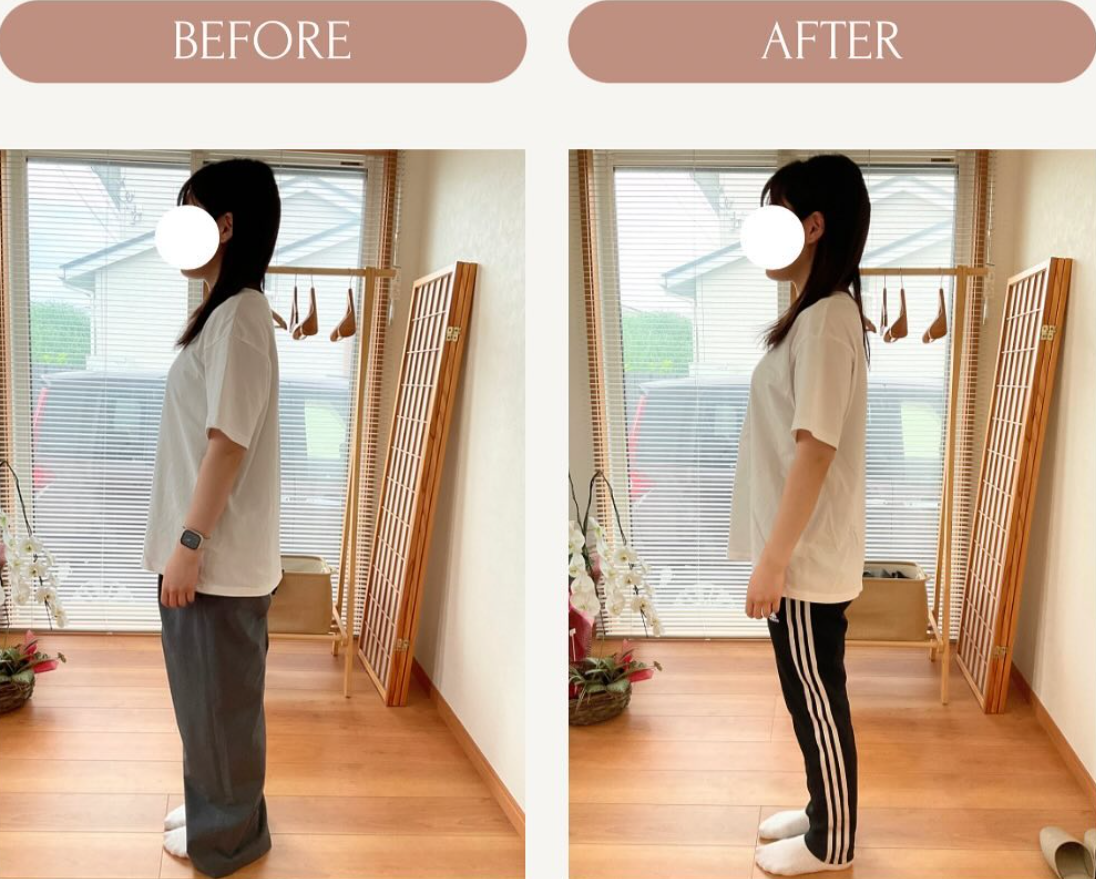 立った姿勢の変化を施術前後で比較した写真
